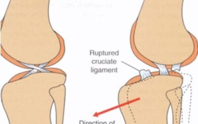 Why Choose MMP Over TPLO for Cranial Cruciate Ligament Tear Of The Dog Knee